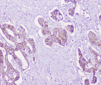 CDH3 / P-Cadherin Antibody