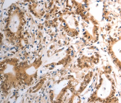 RAD50 Antibody