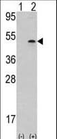 AURKB / Aurora-B Antibody (aa283-313)