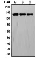 TIE1 / TIE Antibody (Internal)