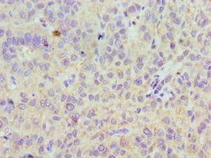 Polyclonal Rabbit anti-Human LYVE1 Antibody (aa20-238, IHC, WB)