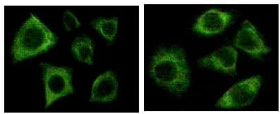Pan Cytokeratin Antibody (clone 7H8C4)