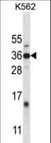 BP1 / DLX4 Antibody (aa72-100)