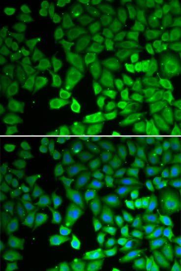 NR4A1 / NUR77 Antibody