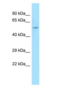 ARHGAP8 Antibody (aa184-233)
