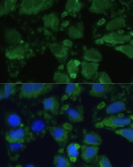 ENO1 / Alpha Enolase Antibody