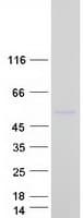 Human MANEAL Protein (Recombinant Myc-DDK (Flag))