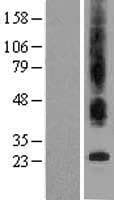 TMBIM6 / Bax Inhibitor 1 Protein (Over-Expression Lysate Myc-DDK (Flag))