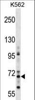 Polyclonal Rabbit anti-Human ZNF256 Antibody (aa203-229, WB)