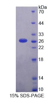 Human CHERP Protein (Recombinant His-T7, N-terminus)