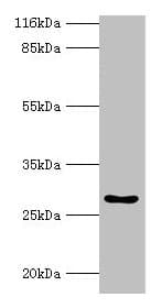 Polyclonal Rabbit anti-Human HOXA6 Antibody (IHC, WB)