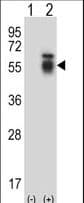 ALK2 / ACVR1 Antibody (aa132-161)