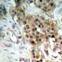 MAP2K4 / MKK4 Antibody (Internal)