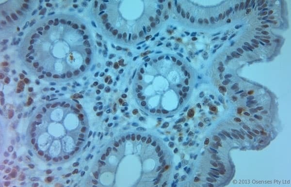 SLC11A2 / DMT1 Antibody