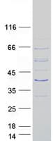 Human TEX26 / C13orf26 Protein (Recombinant Myc-DDK (Flag))