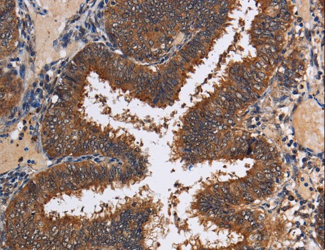 Polyclonal Rabbit anti-Human LRRC57 Antibody (IHC)