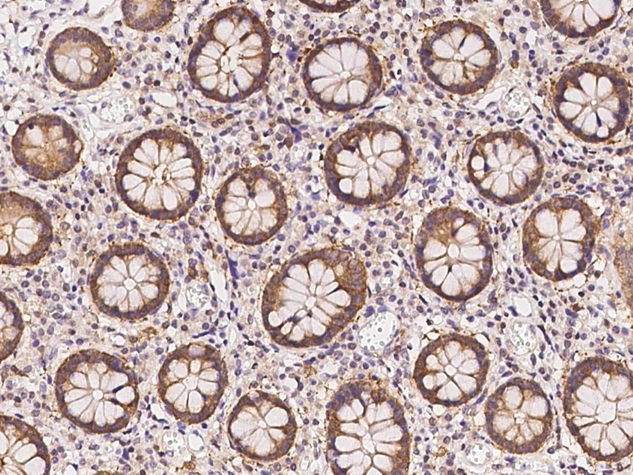 Polyclonal Rabbit anti-Human CACYBP Antibody (IHC, IF, WB)