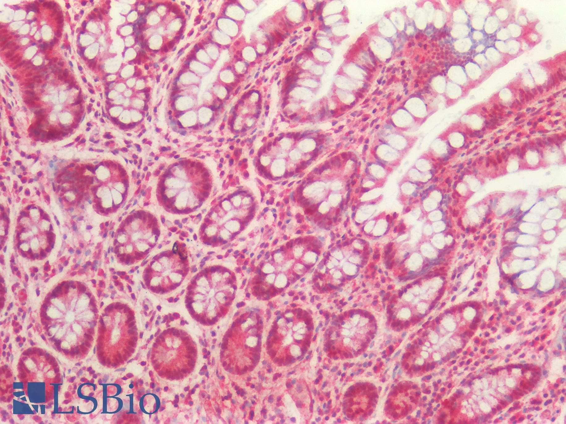 IHC-plus™ TGFB3 / TGF Beta3 Antibody (aa1-265)