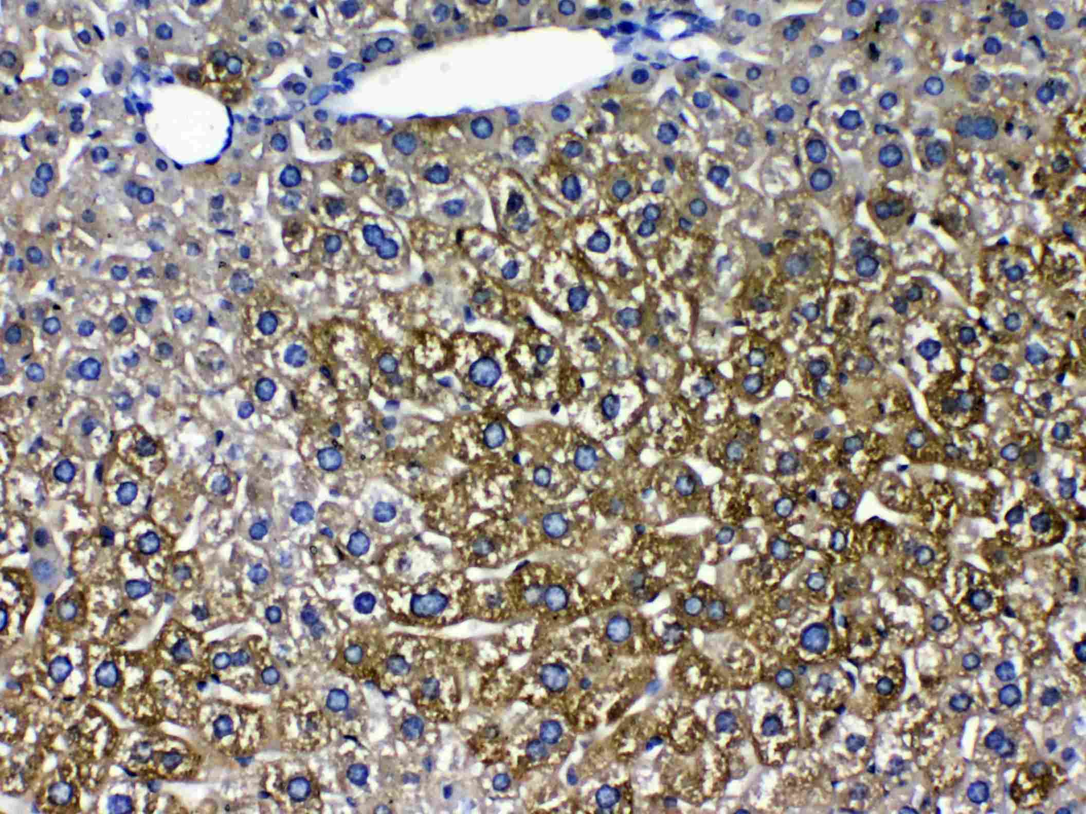 Polyclonal Rabbit anti-Human CYP2D6 Antibody (IHC, WB)
