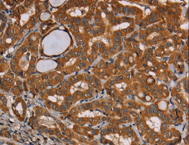 CENPU / MLF1IP Antibody