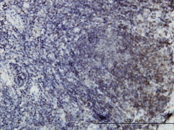 EPHB3 / EPH Receptor B3 Antibody (clone 4E9)