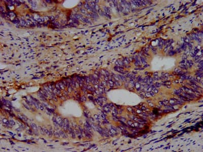 KCNV2 / Kv11.1 Antibody