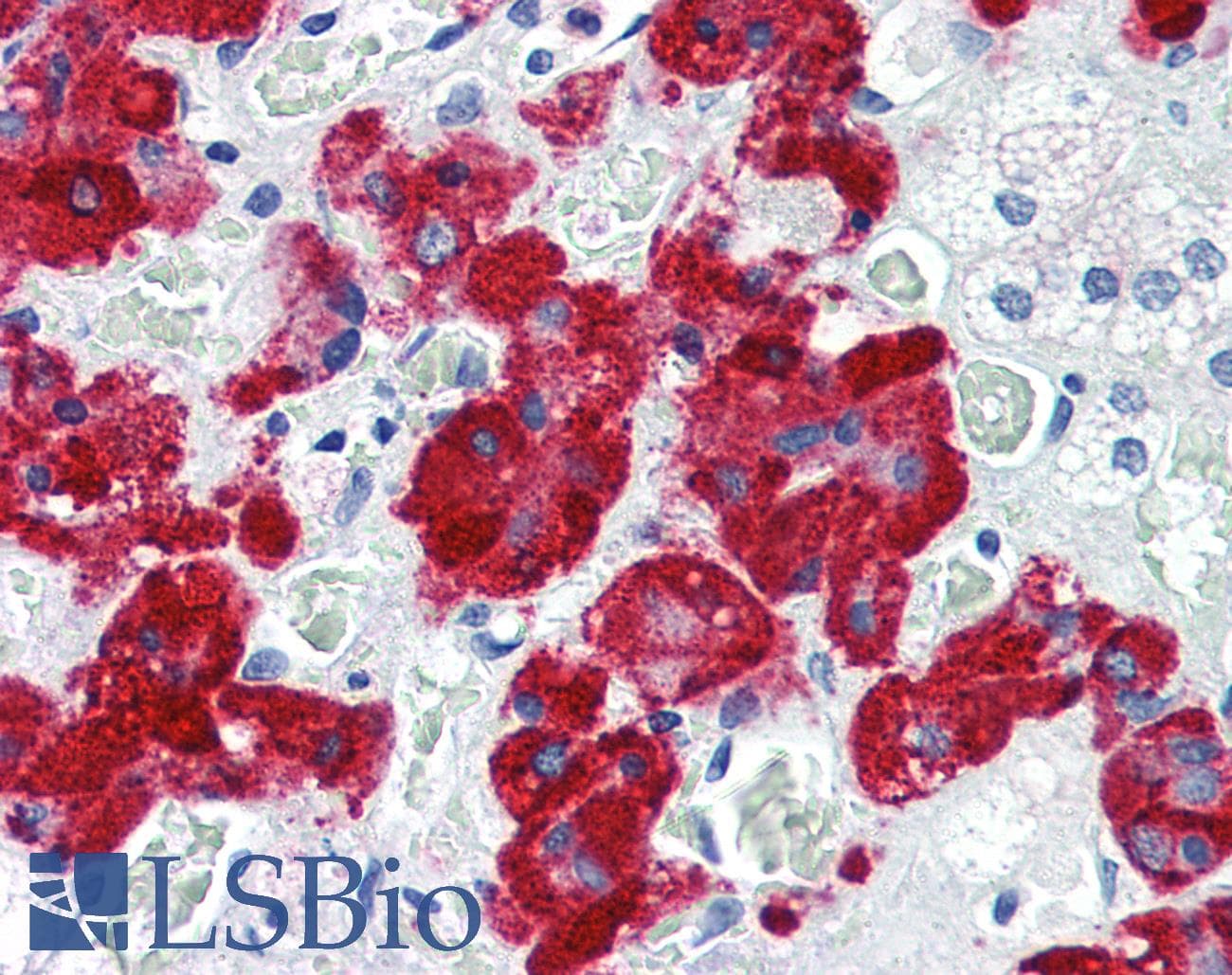 IHC-plus™ VAMP2 / VAMP-2 Antibody (aa1-89, clone 3E5)