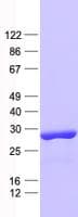 Human RAB3IP / RABIN3 Protein (Recombinant His, N-Terminal)