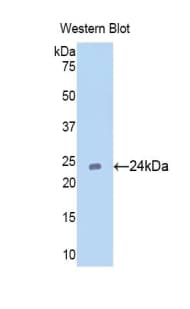 CDC25B Antibody (aa377-566, FITC)