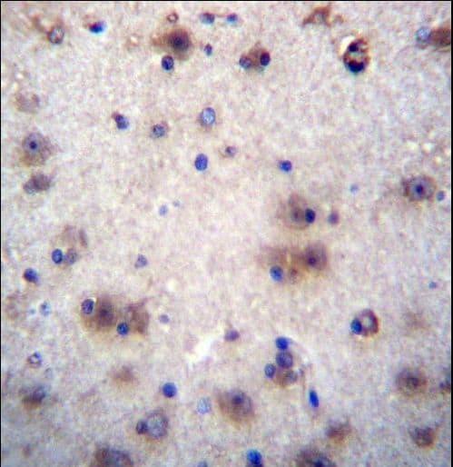 EVPLL Antibody (aa118-146)