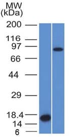 F13A1 / Factor XIIIa Antibody (clone F13A1/1448)