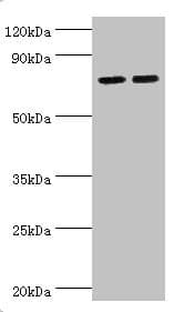 ALOX15B / 15-LOX-2 Antibody (aa1-200)