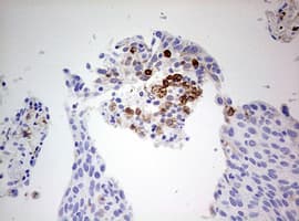 Monoclonal Mouse anti-Human CD68 Antibody (clone OTI8A4, aa22-319, IHC, WB)
