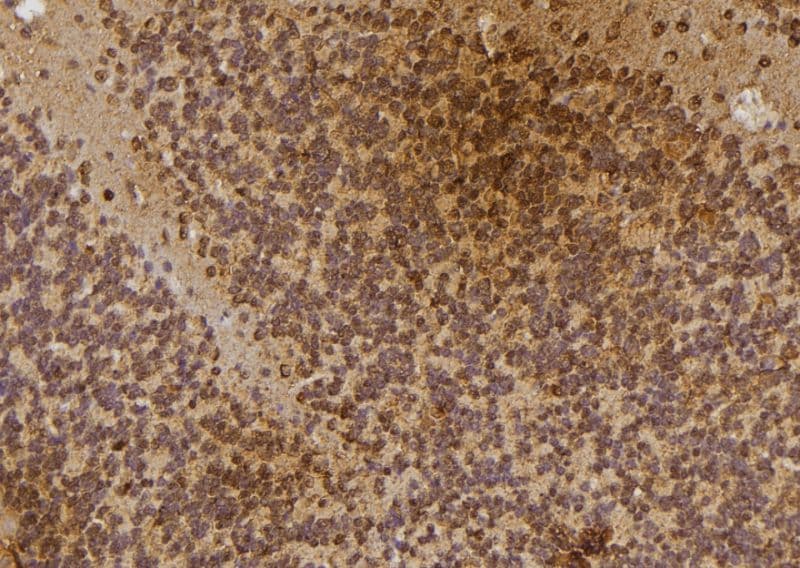 Polyclonal Rabbit anti-Human IP6K3 Antibody (IHC, IF, WB)