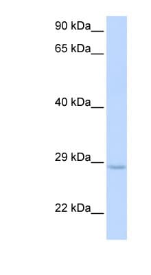 XRCC2 Antibody (aa144-193)