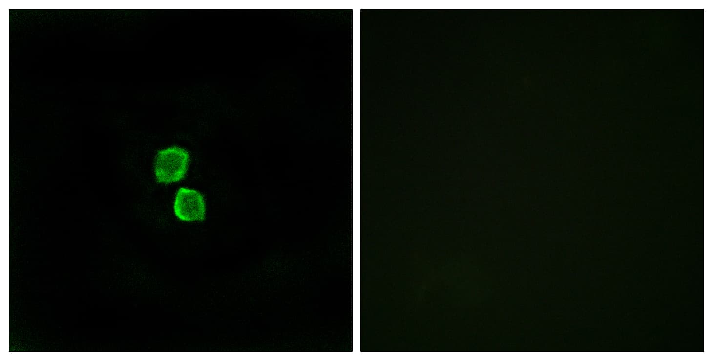 CKLF Antibody (aa120-169)