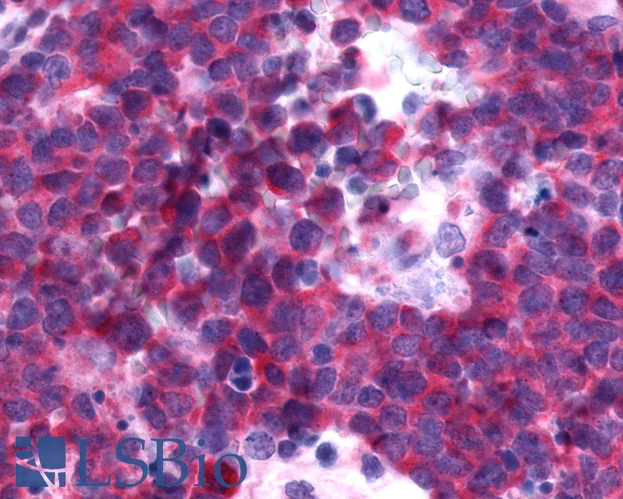 PathPlus™ P2Y13 / P2RY13 Antibody (Cytoplasmic Domain)
