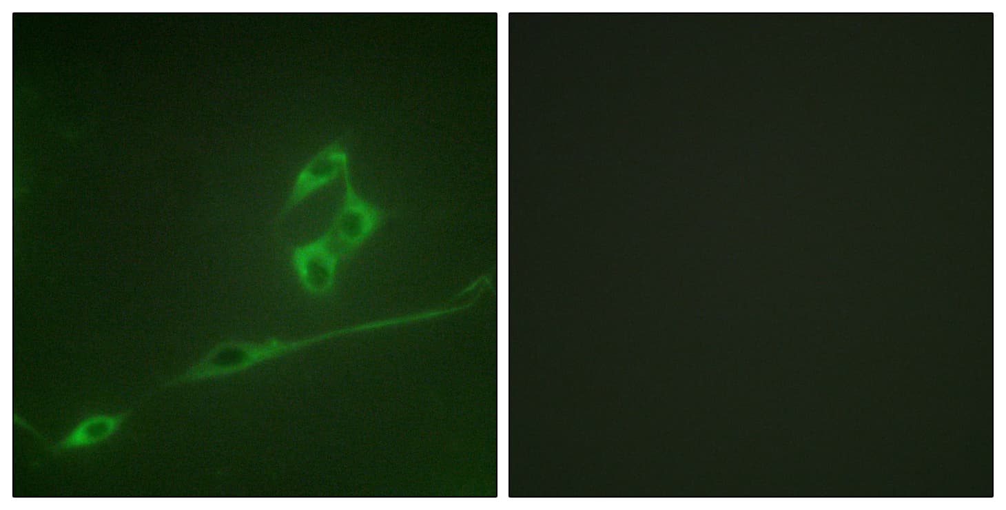 IHC-plus™ RPS6KB1 / P70S6K / S6K Antibody (aa337-386)