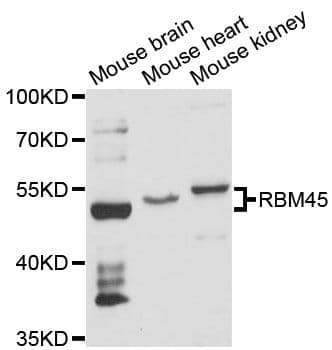 RBM45 / DRB1 Antibody