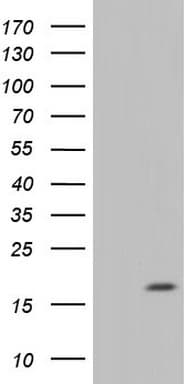 Monoclonal Mouse anti-Human IL20 Antibody (clone OTI6H7, aa25-176, WB)