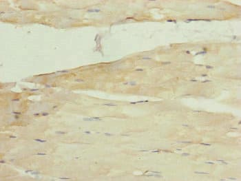 Polyclonal Rabbit anti-Human MRPS22 Antibody (IHC)