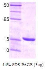 Human UBE2I / UBC9 Protein (Recombinant)