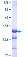 Human ESM1 / Endocan Protein (Recombinant GST, N-terminus)