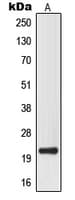Polyclonal Rabbit anti-Human MRPL32 Antibody (Internal, IF, WB)