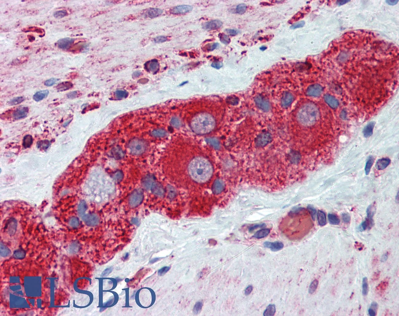 IHC-plus™ TUBB2A / Tubulin Beta 2A Antibody (clone 3C12)
