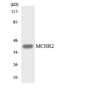 Polyclonal Rabbit anti-Human MCHR2 Antibody (aa283-332, WB)