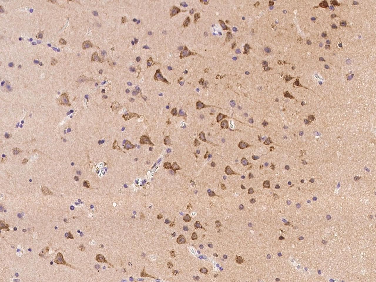 RNF180 Antibody