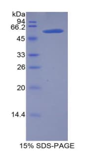 Mouse LIPC / Hepatic Lipase Protein (Recombinant His-GST)