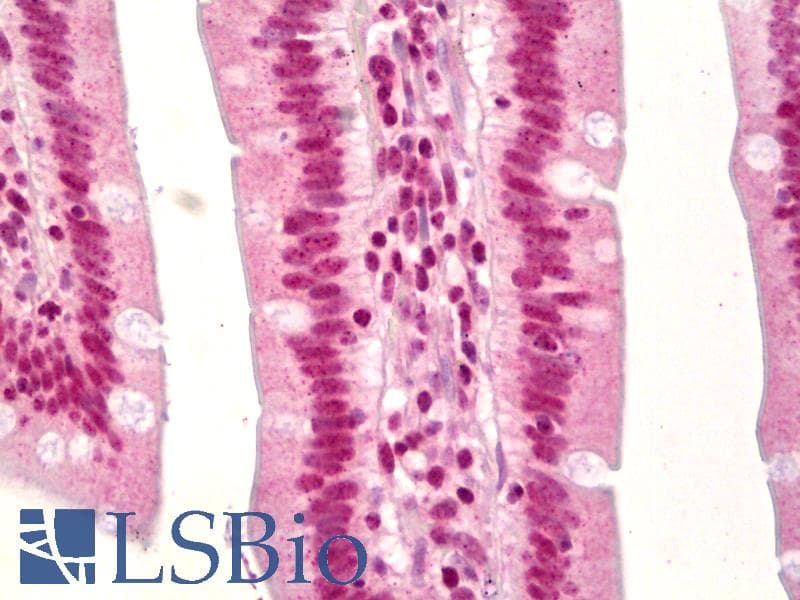 IHC-plus™ Polyclonal Rabbit anti-Human TP53 / p53 Antibody (Acetyl-Lys379, IHC, IF)