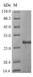 Streptomyces tendae Alpha-amylase inhibitor HOE-467A Protein (Recombinant 10His-SUMO, N-terminus + Myc, C-terminus)